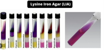 Lysine iron agar